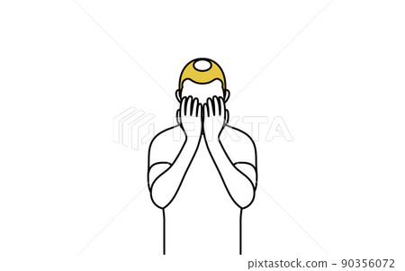 AGA 男性型禿髮，雙手抑鬱 90356072