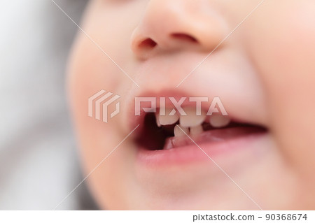 Milk teeth on a 1 year old baby 90368674