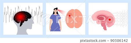 epilepsy seizure concept 90386142