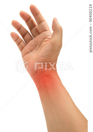 手腕腱鞘炎圖片 手腕腱鞘炎圖片 90400219