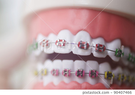 Dental teeth aligners brackets Dental teeth aligners brackets 90407466