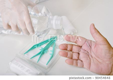 Doctor doing wound dressing care, Hand surgery treatment, Trigger finger stiffness painful Doctor doing wound dressing care, Hand surgery treatment, Trigger finger stiffness painful 90454648