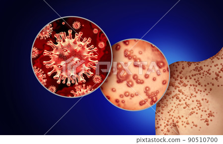 Monkey Pox Virus Monkey Pox Virus 90510700