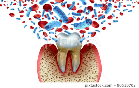 Tooth Decay Blood Bacteria 90510702