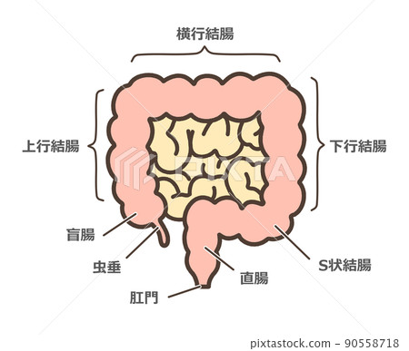 大腸變形圖 90558718