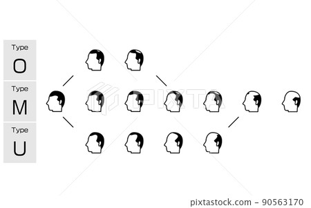 Illustration of each type of AGA androgenetic alopecia and progress stage Illustration of each type of AGA androgenetic alopecia and progress stage 90563170