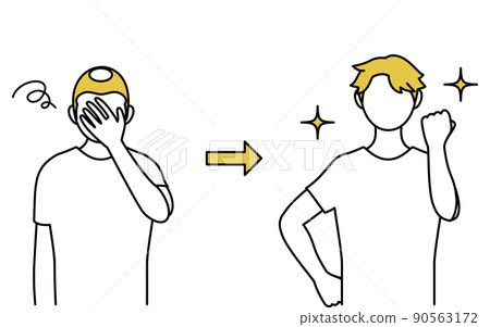 AGA 男性型禿髮，頭髮稀疏 90563172