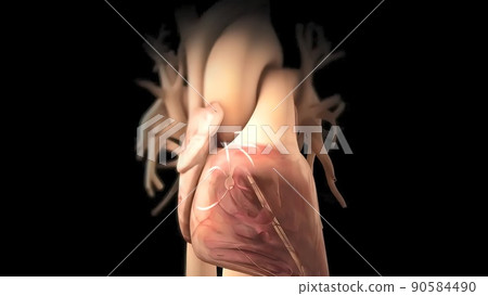 Arrhythmia The normal electrical activity of the heart is the result of the electrical activity 90584490