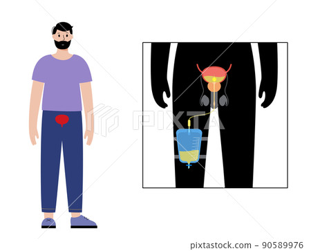 Urinary drainage bag 90589976