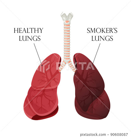 Illustration of normal healthy lungs and lungs smoker. Concept of stop smoking. Vector illustration. 90608087