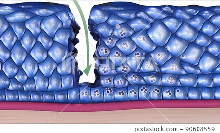 Cancer papilloma virus components 90608559