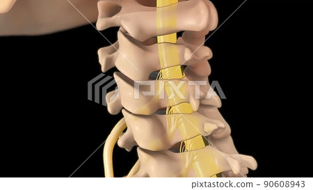 Anatomical view of the cervical spine with intervertebral disc-compressive nerve root prolapse Anatomical view of the cervical spine with intervertebral disc-compressive nerve root prolapse 90608943