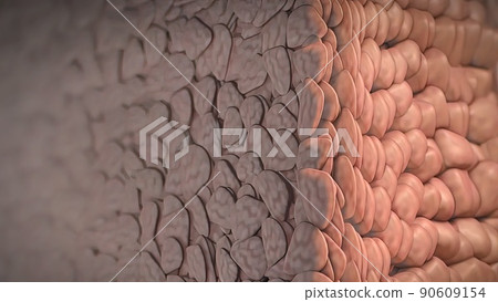 Division and growth of cancerous cells 90609154