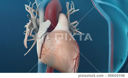 The term angioplasty means using a balloon to stretch open a narrowed 90609396