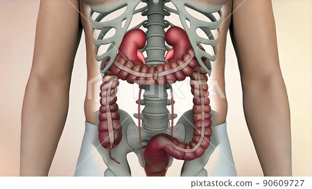Colon during a enteroscopy with a intestinal or bowel cancer tumor visible. Colon during a enteroscopy with a intestinal or bowel cancer tumor visible. 90609727