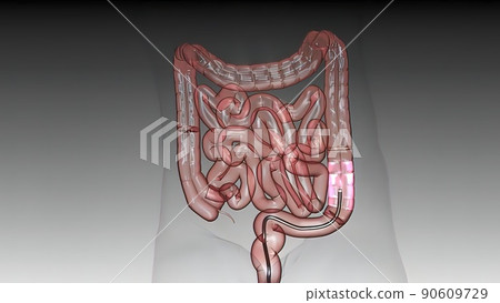 Eamination of the large intestine under amonitor with a fiberoptic camera by entering from the anus Eamination of the large intestine under amonitor with a fiberoptic camera by entering from the anus 90609729