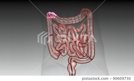 Eamination of the large intestine under amonitor with a fiberoptic camera by entering from the anus Eamination of the large intestine under amonitor with a fiberoptic camera by entering from the anus 90609730