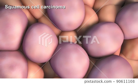 Division and growth of cancerous cells Division and growth of cancerous cells 90611108