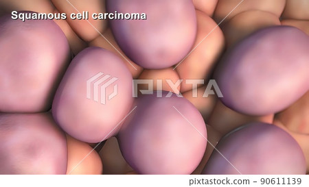 Division and growth of cancerous cells 90611139