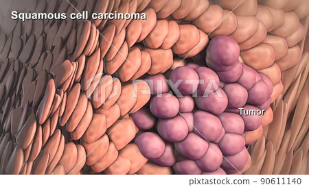 Division and growth of cancerous cells Division and growth of cancerous cells 90611140