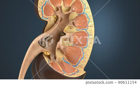 Kidney Stone Treatment. Lithotripsy. Kidney Stone Treatment. Lithotripsy. 90611154