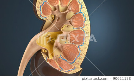 Kidney Stone Treatment. Lithotripsy. Kidney Stone Treatment. Lithotripsy. 90611158