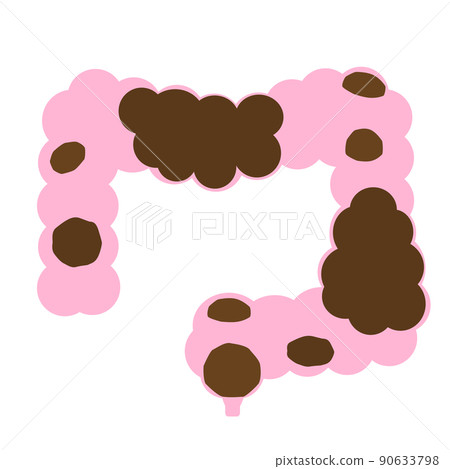 便秘的圖像。聚集在不健康腸道中的便便。 90633798