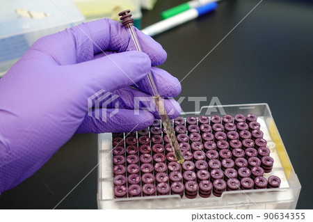 血漿樣品 血漿樣品 90634355