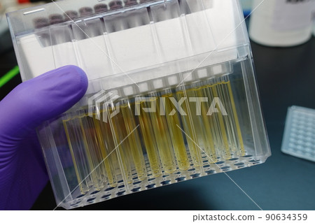plasma sample 90634359