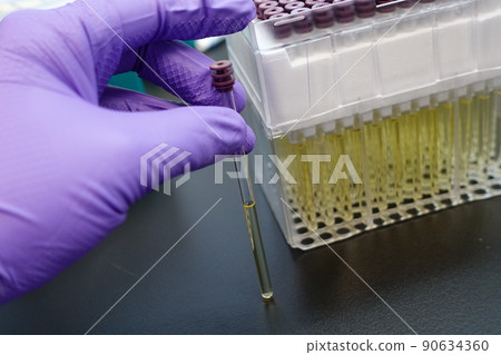 血漿樣品 血漿樣品 90634360