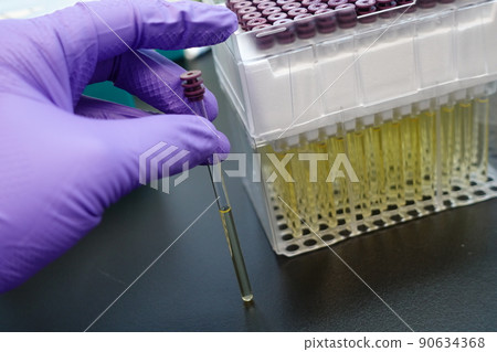 plasma sample 90634368