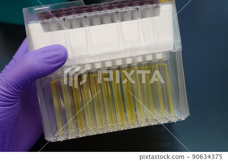 血漿樣品 血漿樣品 90634375