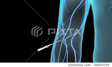 Aspiration venous blood from the leg into the body 90650594