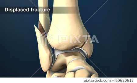 The fibula helps stabilize and support your leg, body, ankle, and leg muscles The fibula helps stabilize and support your leg, body, ankle, and leg muscles 90650612