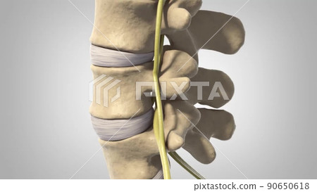 Disc shifting and nerve entrapment - Stock Illustration [90650618] - PIXTA