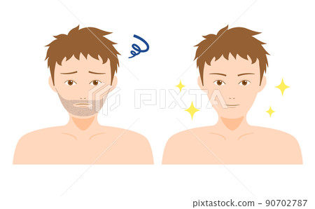 Beard Hair Removal Male Before After Beard Hair Removal Male Before After 90702787