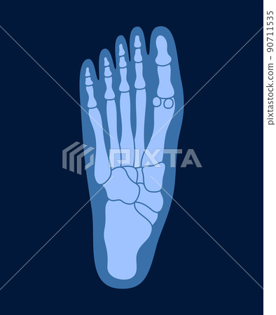 X-ray of human foot bones. Human joint anatomy x-rays vector illustration. 90711535