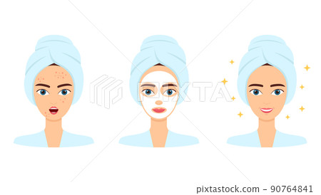 Young woman with acne. Treatment, before and after skincare. Face mask, beauty concept, vector illustration 90764841