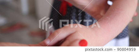 Woman holding child hand with sunburn closeup Woman holding child hand with sunburn closeup 90804959