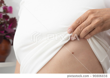 Woman showing birthmark on body Woman showing birthmark on body 90806838