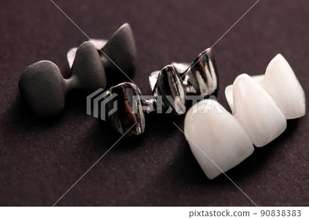 Teeth implant and crown installation process parts isolated on a black background. Medically accurate 3D model. Teeth implant and crown installation process parts isolated on a black background. Medically accurate 3D model. 90838383