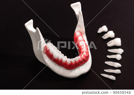 Teeth implant and crown installation process parts isolated on a black background. Medically accurate 3D model. Teeth implant and crown installation process parts isolated on a black background. Medically accurate 3D model. 90838548