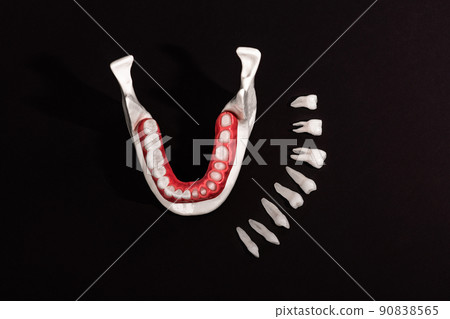 Teeth implant and crown installation process parts isolated on a black background. Medically accurate 3D model.  90838565