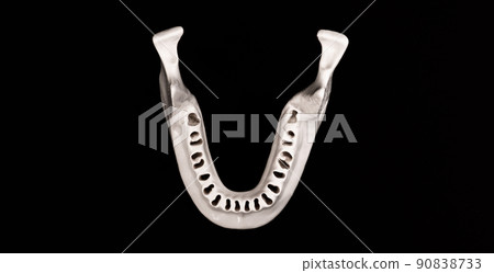 Upper human jaw without teeth model medical implant isolated on black background. Healthy teeth, dental care and orthodontic concept. 90838733