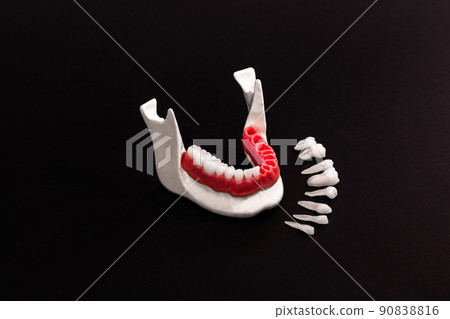 Teeth implant and crown installation process parts isolated on a black background. Medically accurate 3D model.  90838816
