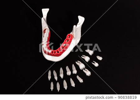 Teeth implant and crown installation process parts isolated on a black background. Medically accurate 3D model.  90838819