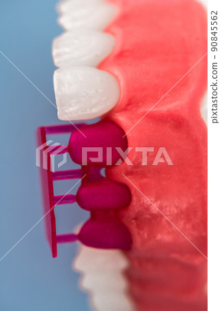 Teeth implant and crown installation process parts isolated on a blue background. Medically accurate 3D model.  90845562