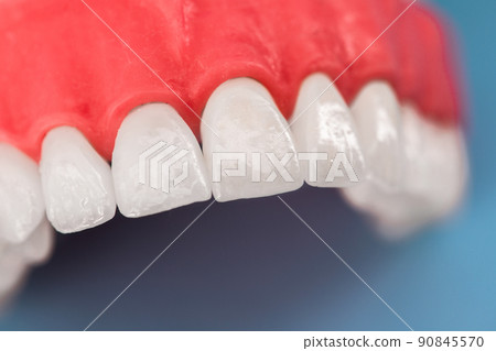 Teeth implant and crown installation process parts isolated on a blue background. Medically accurate 3D model.  90845570