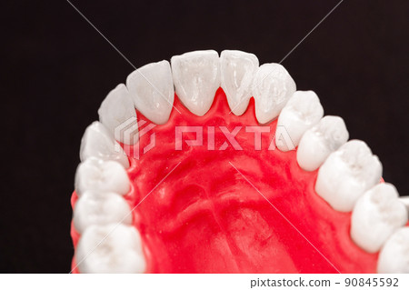 Teeth implant and crown installation process parts isolated on a blue background. Medically accurate 3D model. Teeth implant and crown installation process parts isolated on a blue background. Medically accurate 3D model. 90845592