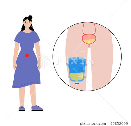 Urinary drainage bag 90852099